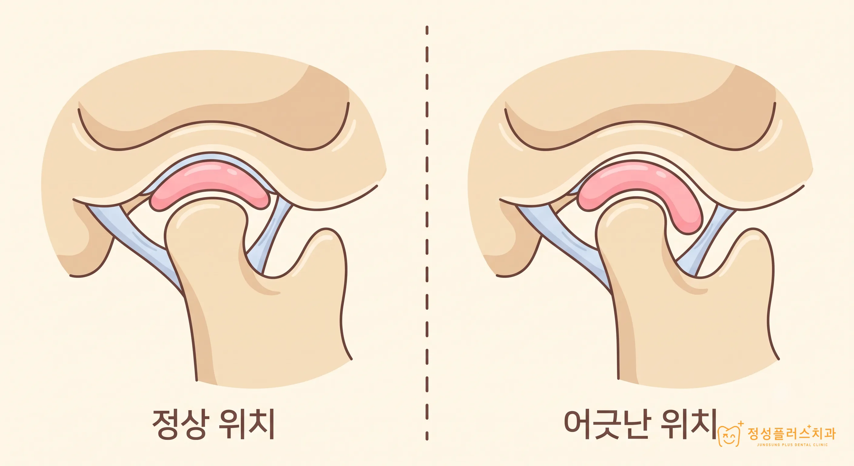 부천 고강동 치과 입 벌릴 때 턱이 한쪽으로 치우치는 이유